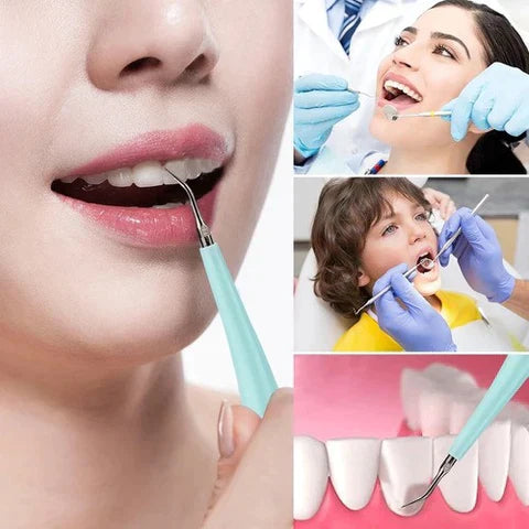 Removedor de Tártaro e Sujeiras - Dental